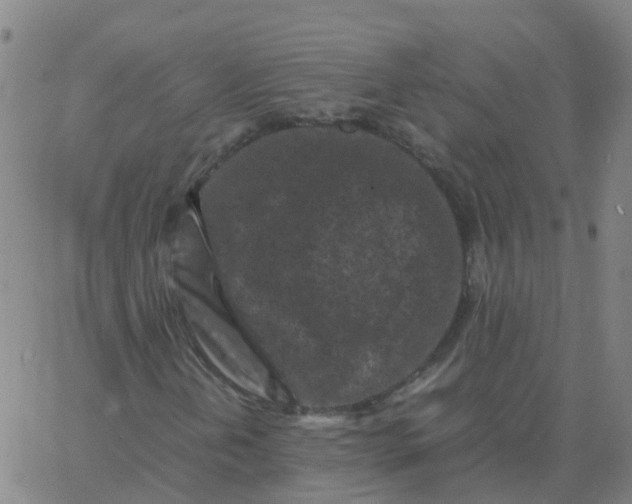 X0000066101202200603312016