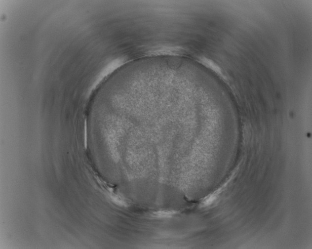 X0000066101219200603312017