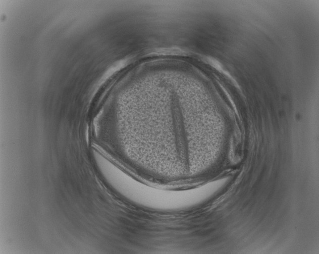 X0000066101221200603312017