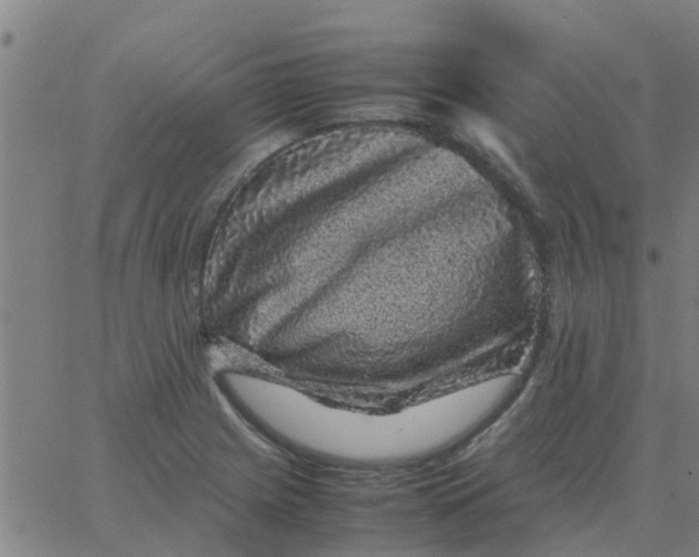 X0000066101225200603312017