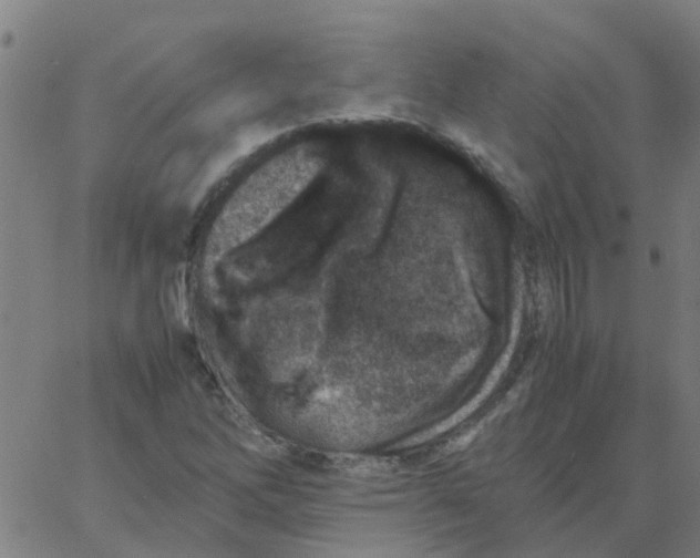 X0000066101262200603312016