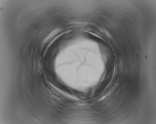 X0000066101354200603312015