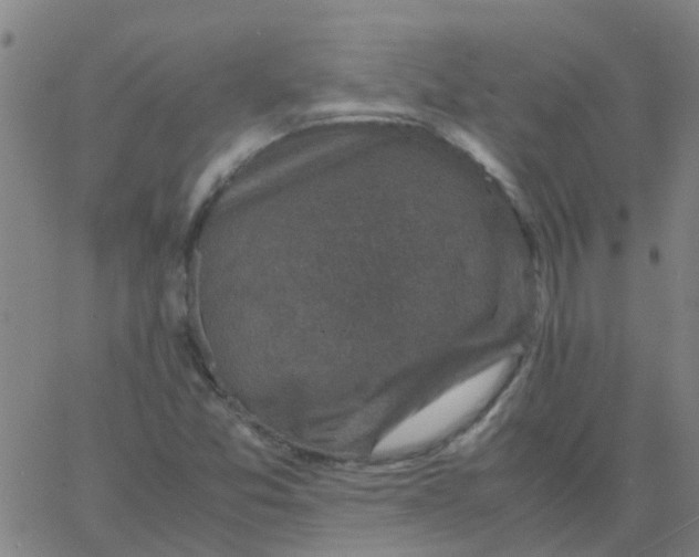 X0000066101357200603312015