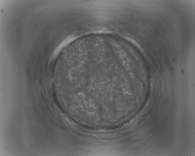 X0000066101359200603312014