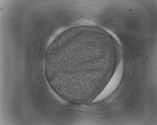 X0000066101383200603312014