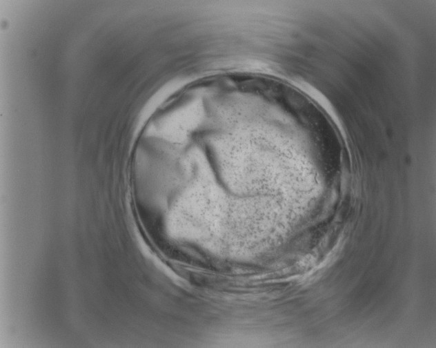 X0000066101389200603312014