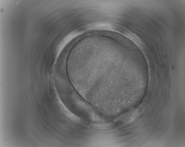 X0000066101392200603312014