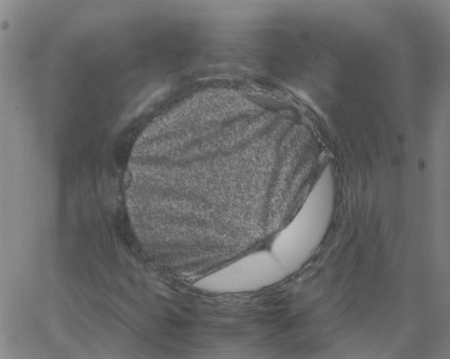 X0000066101399200603312013