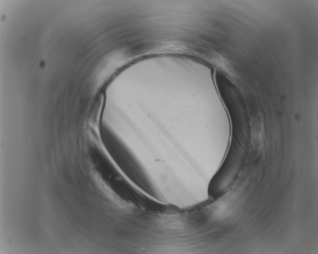 X0000066101422200603312014