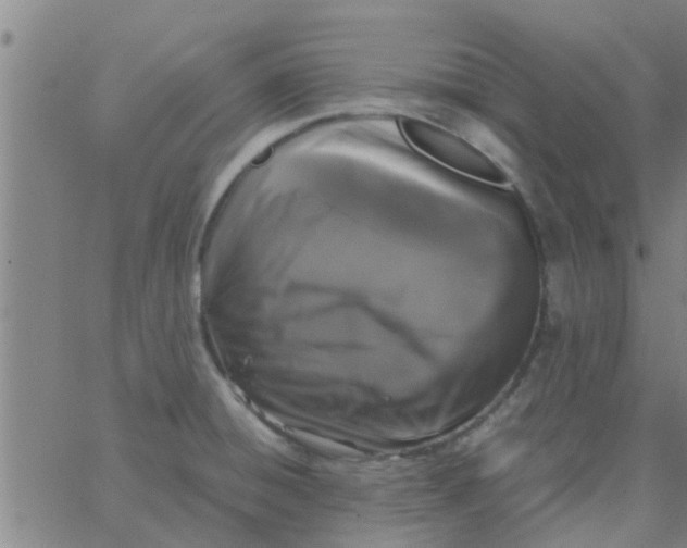 X0000066101428200603312014