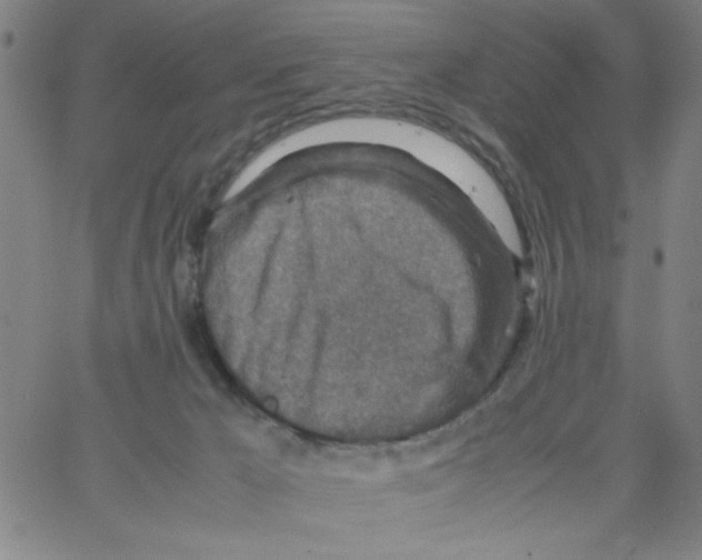 X0000066100029200604071833