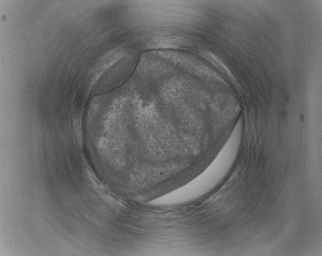 X0000066100386200604071827