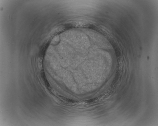 X0000066100695200604071822