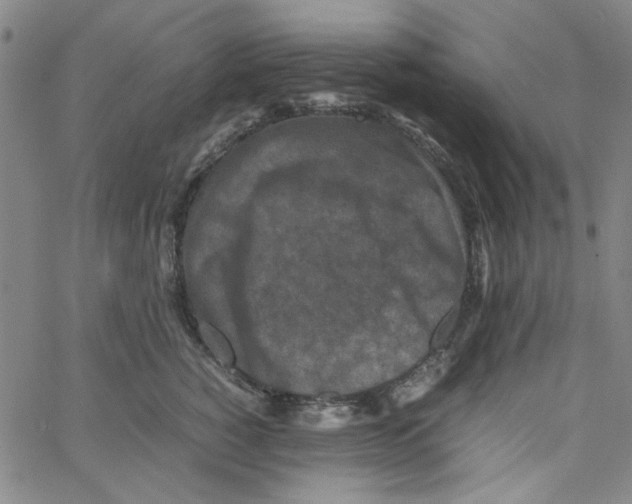 X0000066100760200604071822