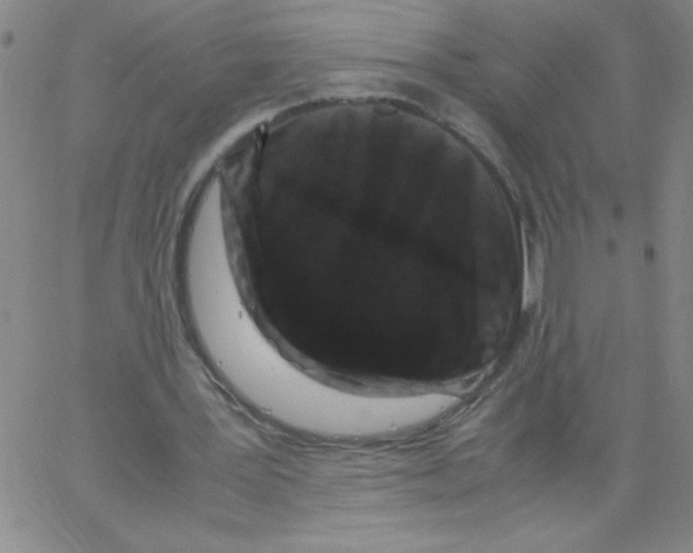 X0000066110387200604071852