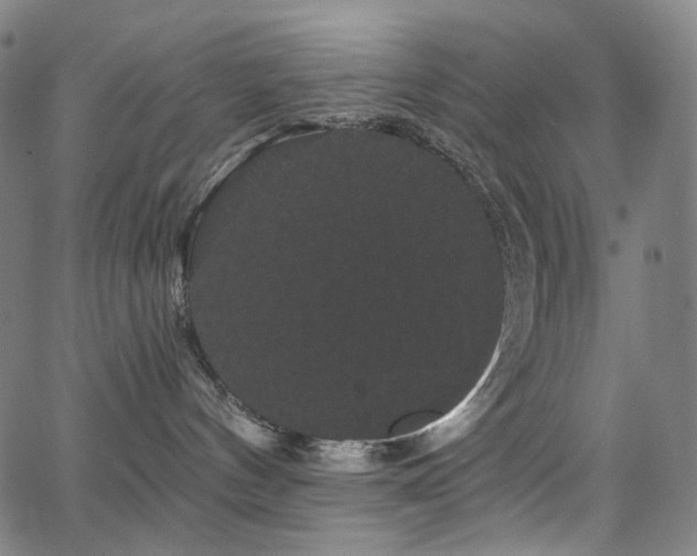 X0000066120144200603101245