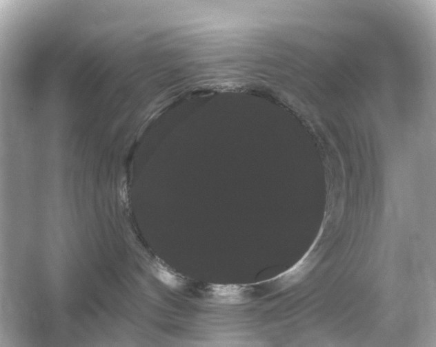 X0000066120144200603131338