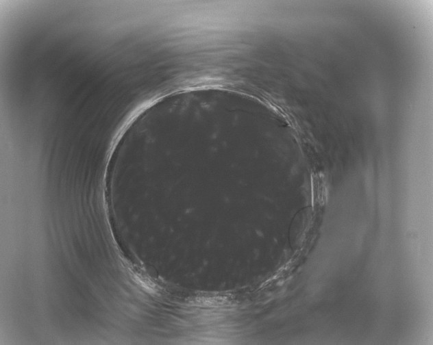 X0000066120147200603131337