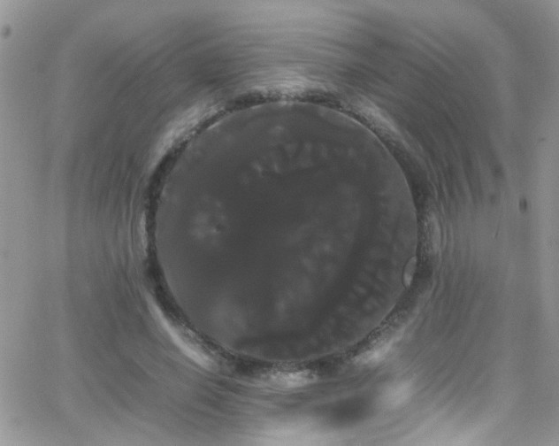 X0000066500638200603171149