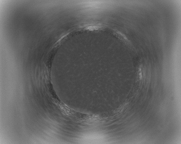X0000066501158200603201315