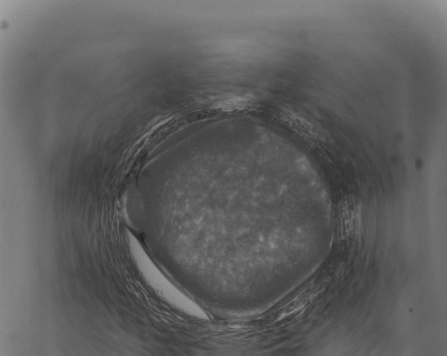 X0000066511158200603311722