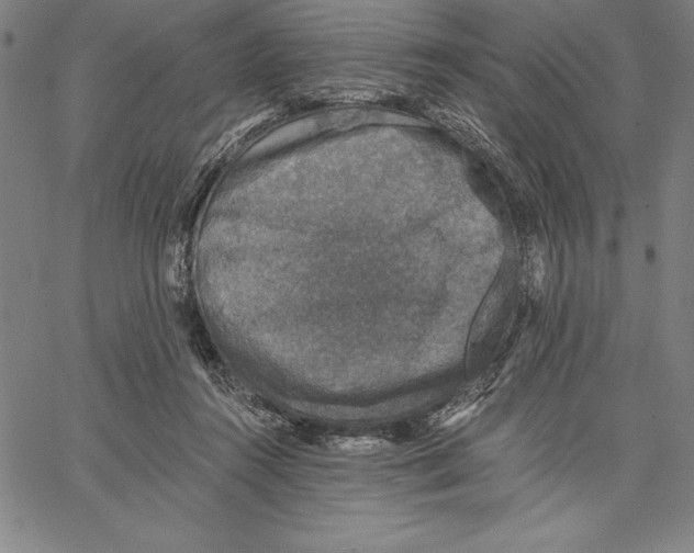 X0000066510360200604071533
