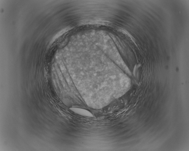 X0000066511064200604071521