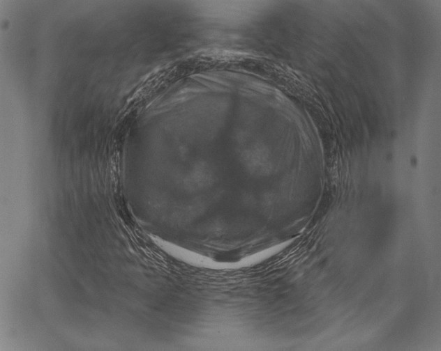 X0000066511397200604071515