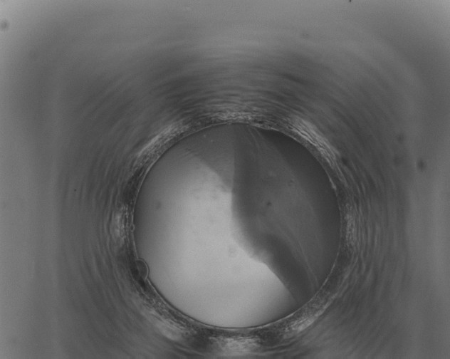 X0000066520165200603311803