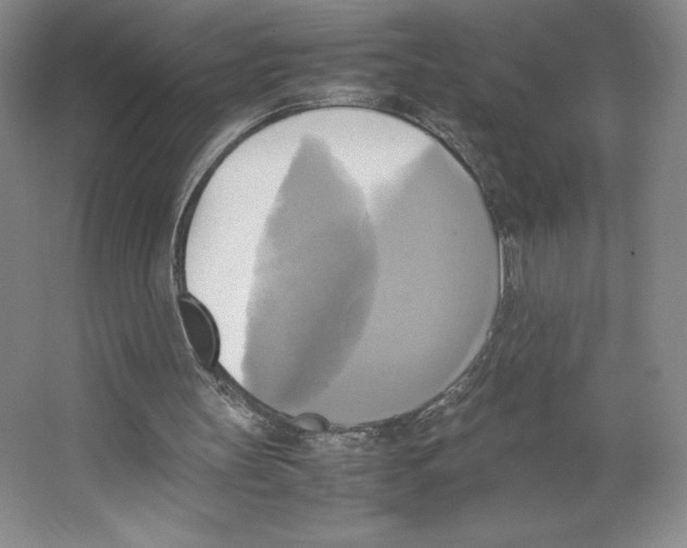 X0000066520147200604141823