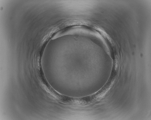 X0000066540585200603171243