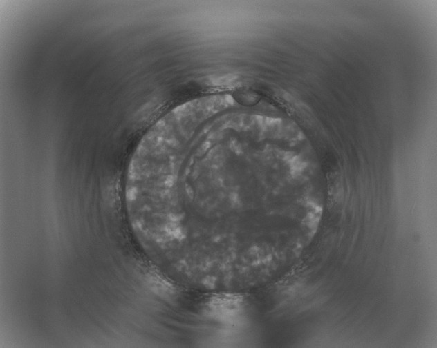 X0000066540369200604141911
