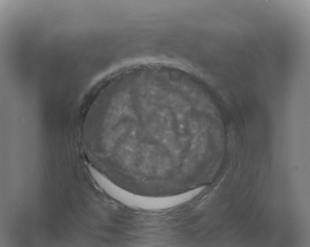 X0000066931494200604141944