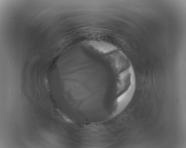 X0000066941013200604142018