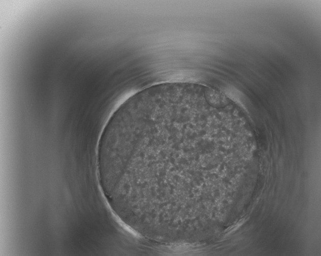 X0000066941087200604142017