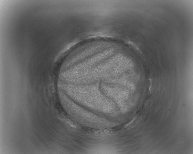 X0000066951159200604142042