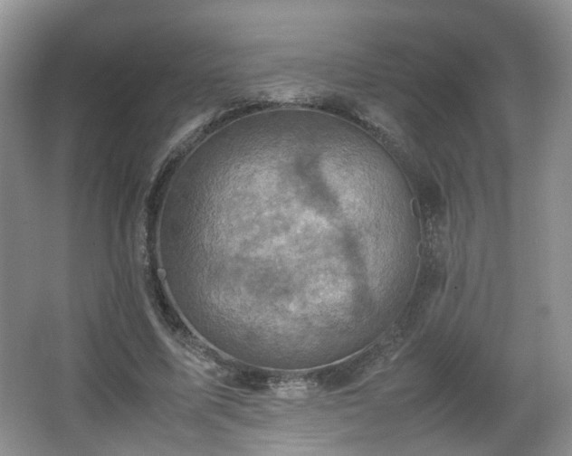 X0000066960587200603311425