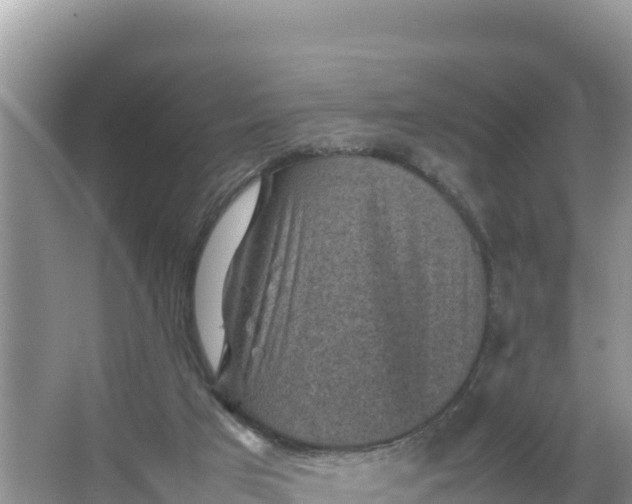 X0000066960017200604072016