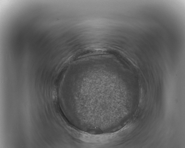 X0000066960048200604072016