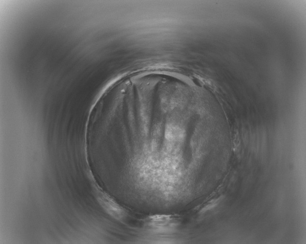 X0000066960052200604072015