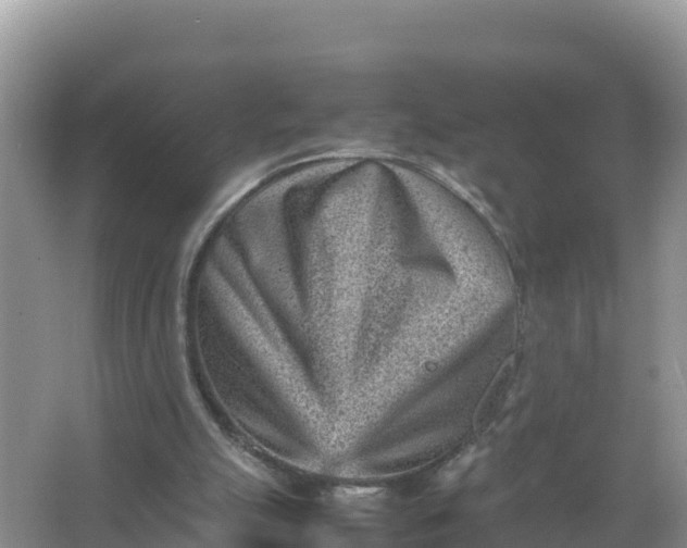 X0000066960055200604072015