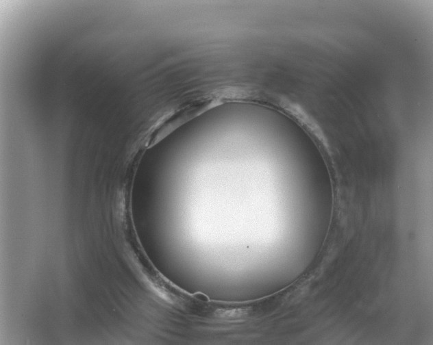 X0000066960057200604072015