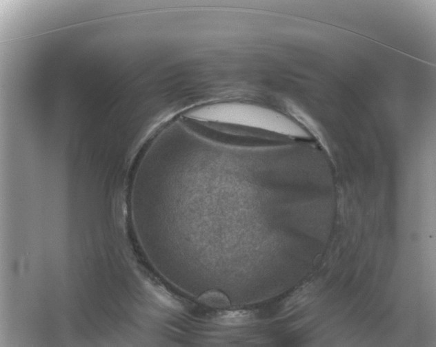 X0000066960059200604072015