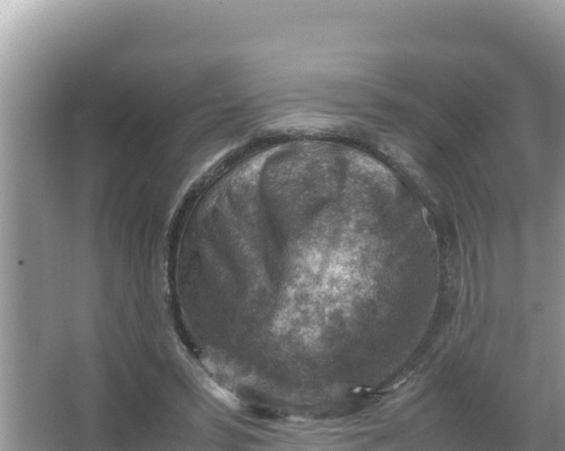 X0000066960399200604072010