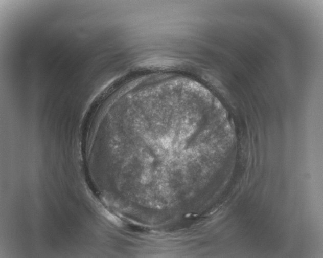 X0000066960399200604142120