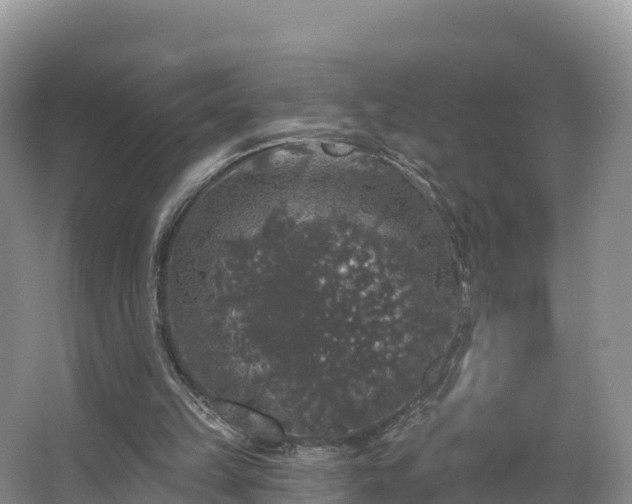 X0000066970149200603311458