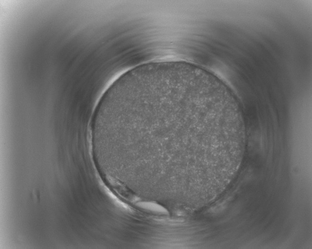 X0000066971476200604072017