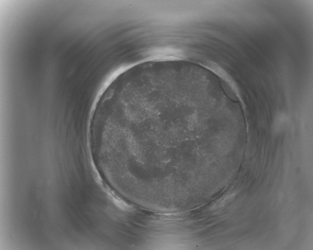 X0000066971488200604072017