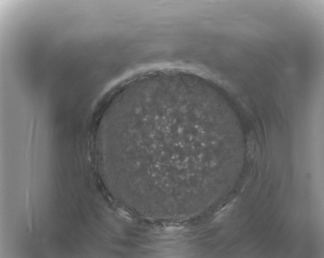 X0000066971494200604072016