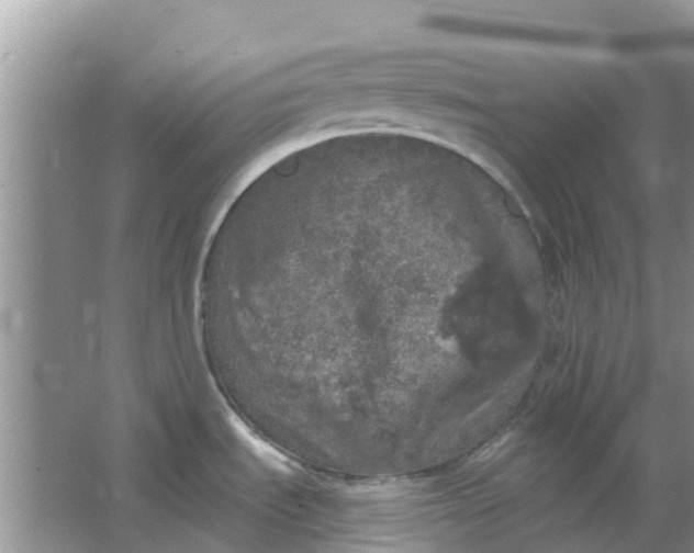 X0000066971535200604072017